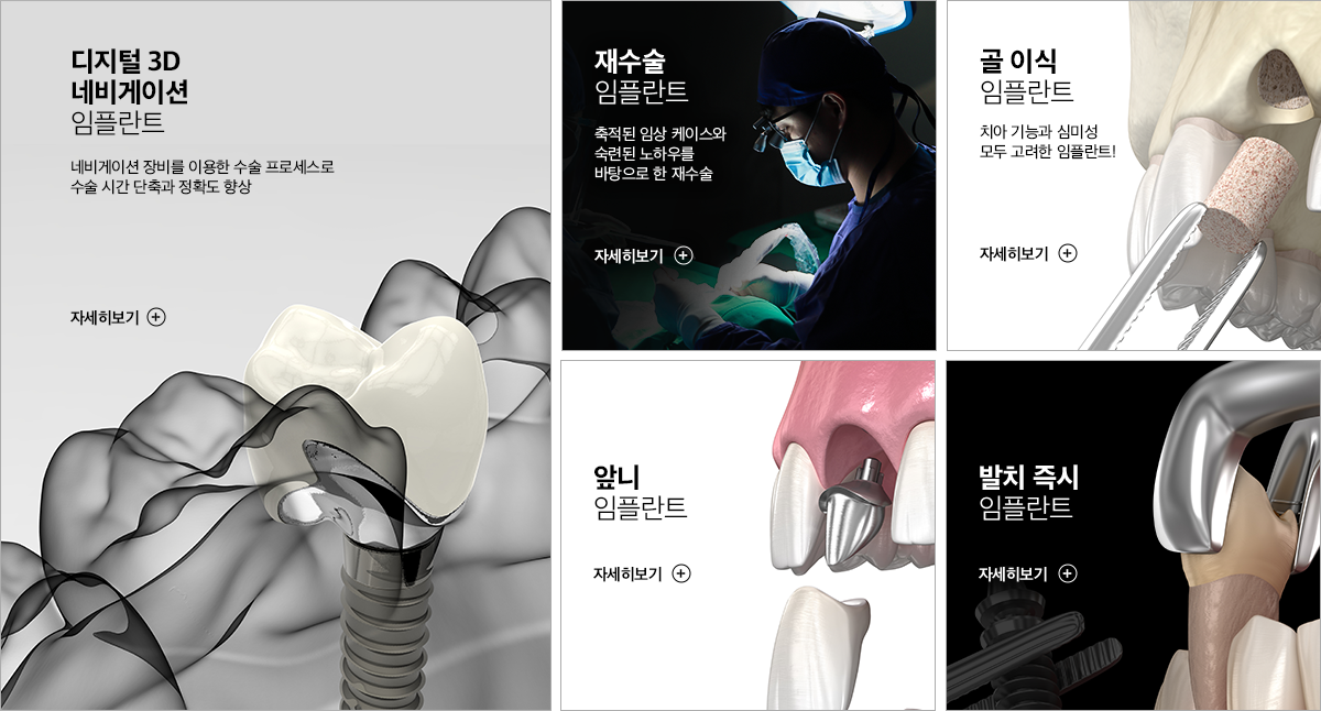 임플란트 클리닉